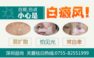 深圳白癜风医院哪家好介绍儿童白斑的辅助治疗有哪些