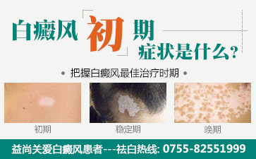 深圳市宝安区那个治白斑的医院好患发了白癜风之后皮肤会有哪些变化