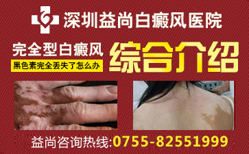 深圳宝安区有几家白斑病医院孩子脸上的白斑怎么治疗