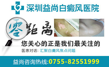 深圳宝安区哪个医院看白斑最好白斑患者要怎么做才能避免病情恶化