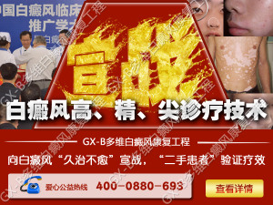 白癜风治疗新方法
