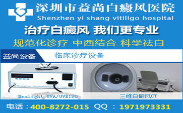 白癜风患者要如何缓解心理压力