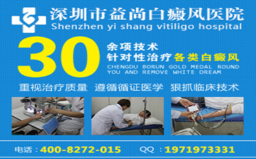 儿童患上局限型白癜风要如何护理