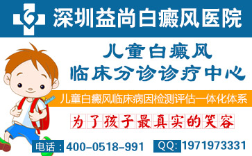 ΪʲôỼ