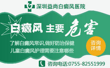 深圳宝安区哪个医院治疗白斑病比较好儿童白癜风的预防方法